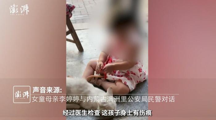 2岁多女童抢救无效死亡！父亲承认时常殴打孩子