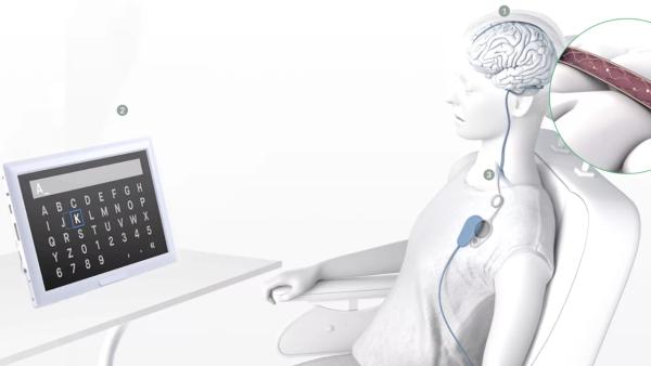 解读｜芯片植入人脑待长期评估，马斯克脑机接口终极目标：人与AI共生