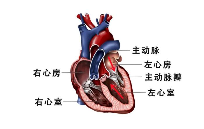 13岁男孩“心门”堵塞，一年晕厥4次，医生迎战高难度手术