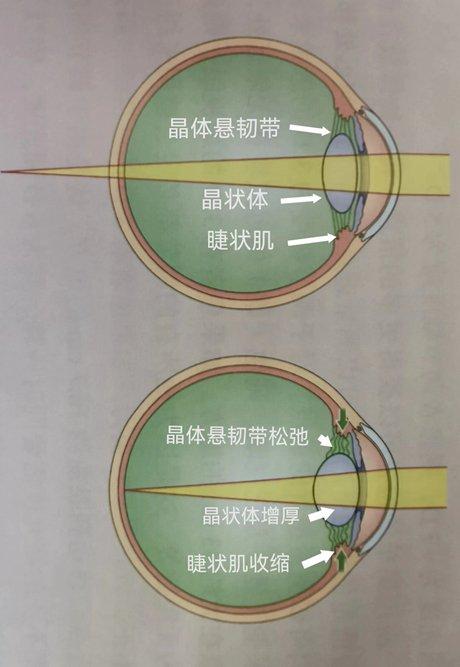 开学季，你家孩子的“远视储备”余额还多吗