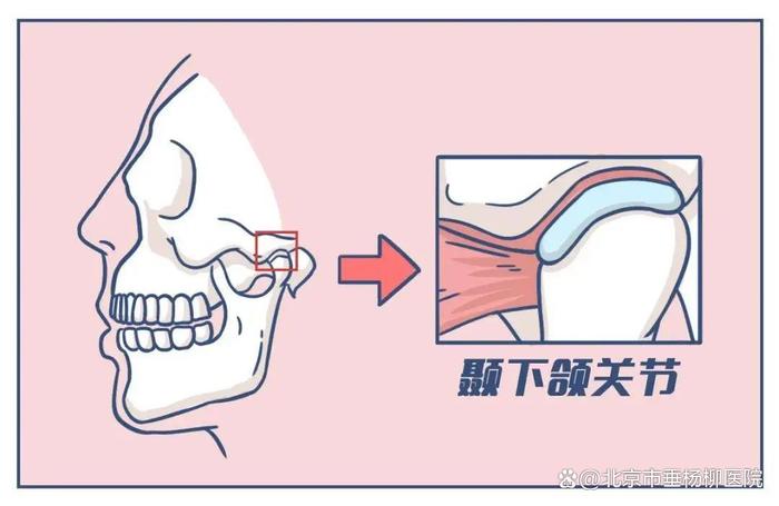 垂医科普 | 颞下颌关节疾病：生活中不可忽视的痛