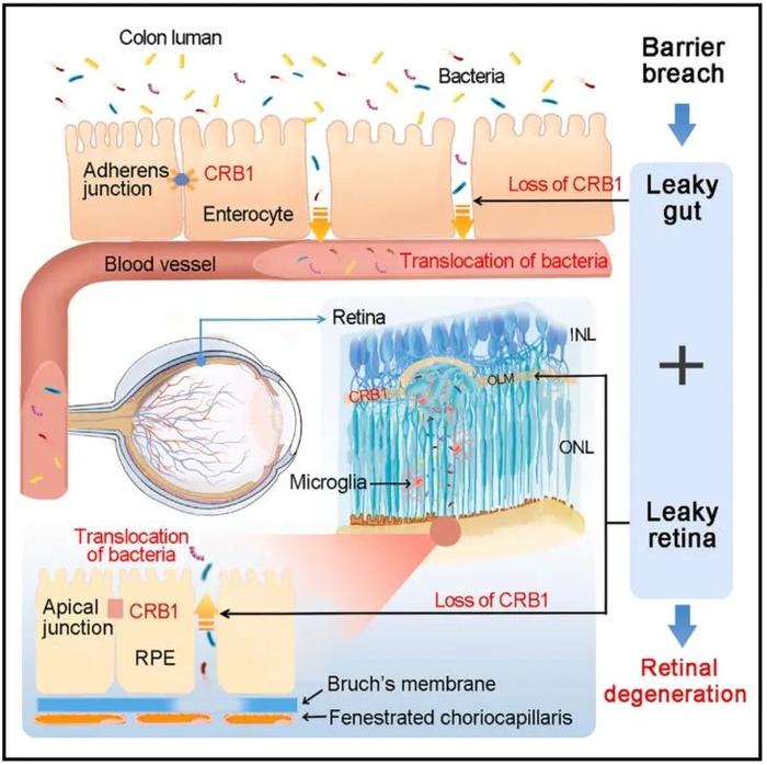 《细胞》：颠覆认知！中国科学家首次发现，肠菌竟然能直接参与遗传性视网膜变性，抗生素治疗或可阻止疾病进展丨科学大发现(图2)