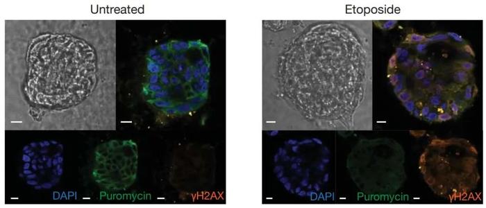改写教科书！《科学》找到“化疗杀癌”新原因，或影响未来癌症治疗