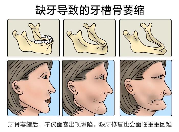 首批名额发放，市民朋友皆可领取，有这些问题的人注意了...