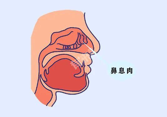 提醒：身上这些「肉」是癌症先兆！这几种你必须切