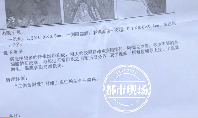 在南昌“辉煌口腔”做正畸，牙没矫好还要“割舌”？