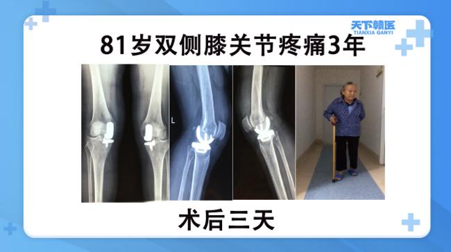 心生自卑、疼痛不已！性格开朗的她3年不愿出门……