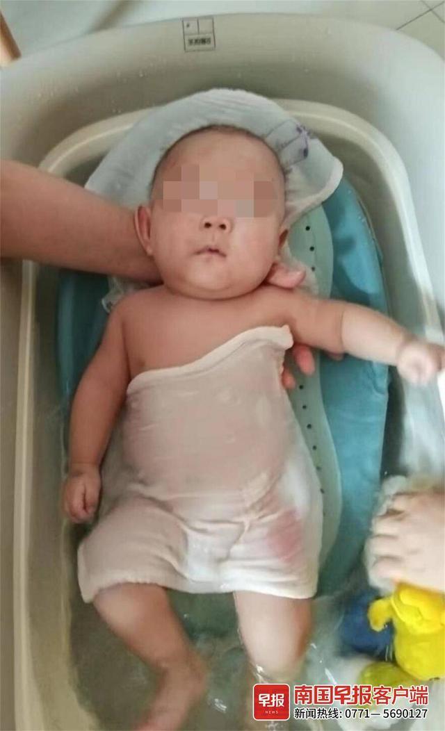 7公斤啦！出生仅900克的“巴掌宝宝”被救治后健康出院