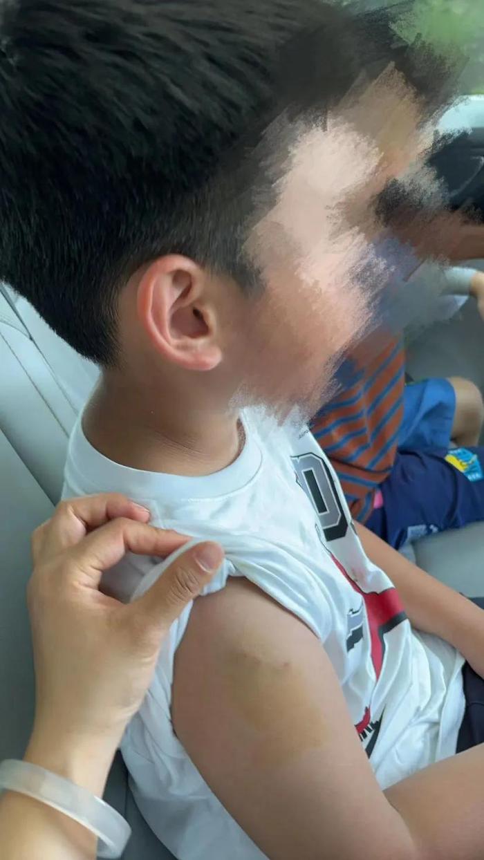 北京延庆一猕猴咬伤7岁男孩：非首次伤人，来源未明
