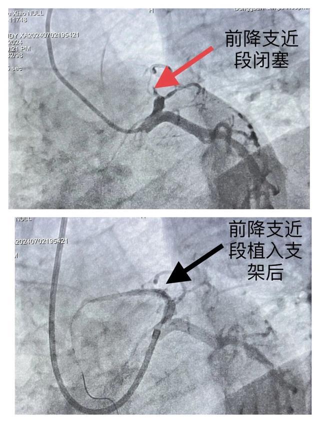 “急疯了！”被连挂5次，医生坚持电话“轰炸”最终抢回男子一条命