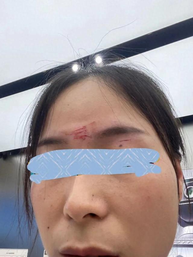 危险！宁波女子在商场里被无人机撞脸，“会留疤”！更气人的是……