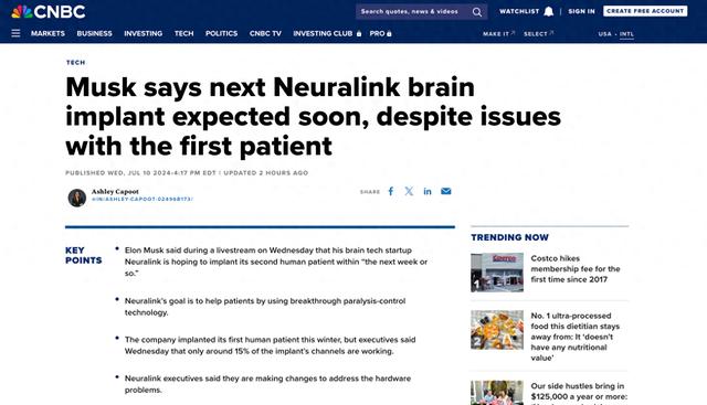 马斯克透露脑机接口实验新消息：第二例将开启，并计划今年植入多位患者