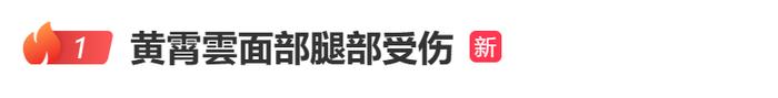 知名女歌手突遭车祸，面部腿部受伤，最新回应