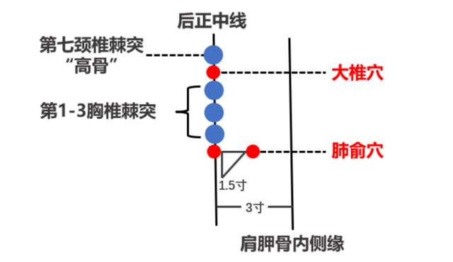 草原科普 | 不是人人适用，“三伏贴”你贴对了吗？