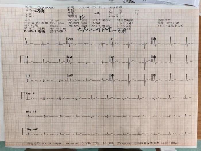 心慌老人10年未确诊，辗转多家医院终于确认病因......