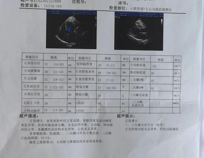 心慌老人10年未确诊，辗转多家医院终于确认病因......