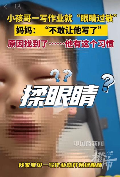 对作业“过敏”？男孩一写作业眼睛就肿成“灯泡”