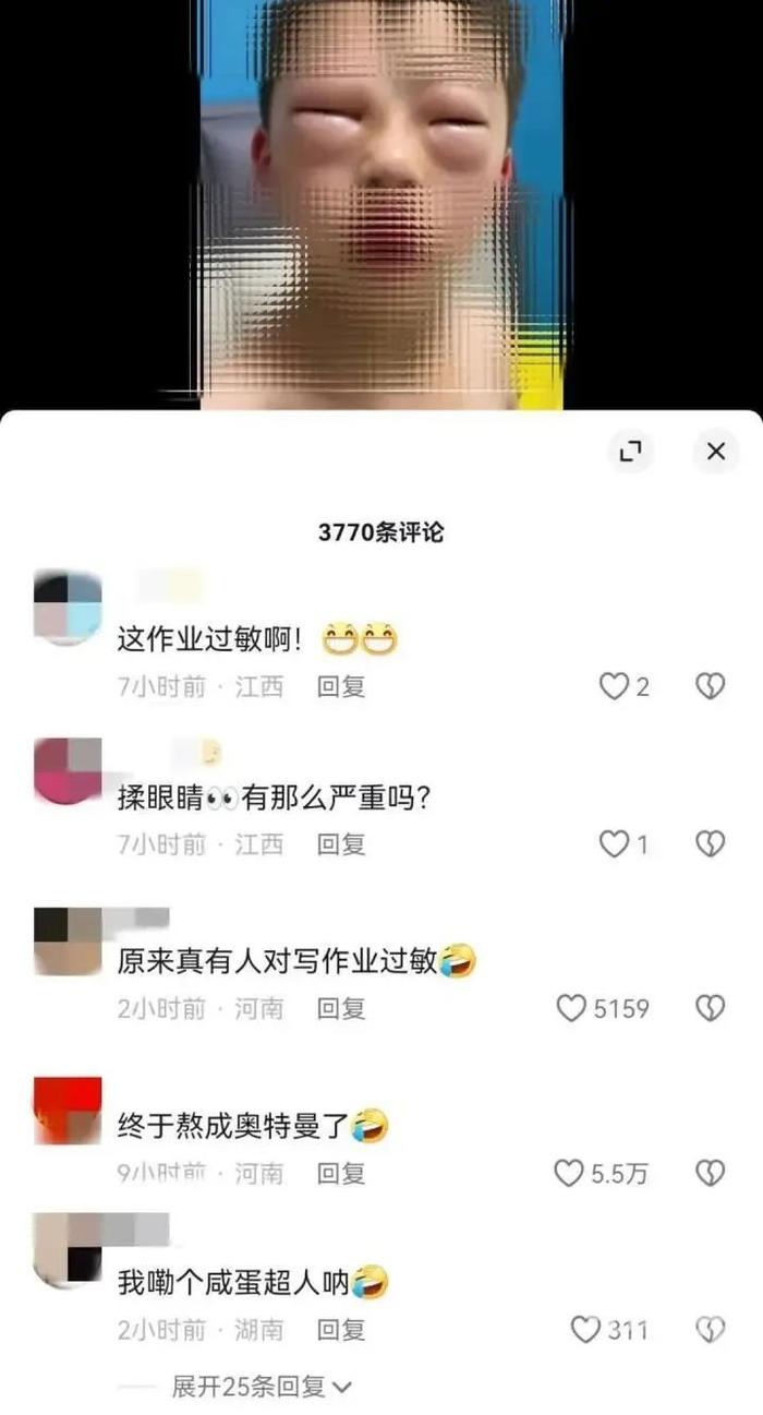 对作业“过敏”？男孩一写作业眼睛就肿成“灯泡”