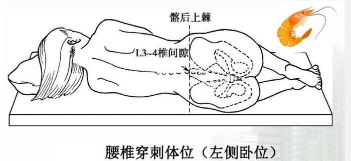 麻醉科丨进入手术室后最难受也是最舒适的是这个瞬间！