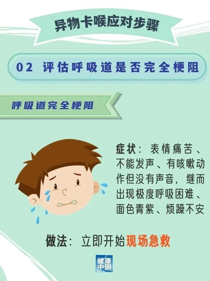 【一图胜千言】异物卡喉现场急救