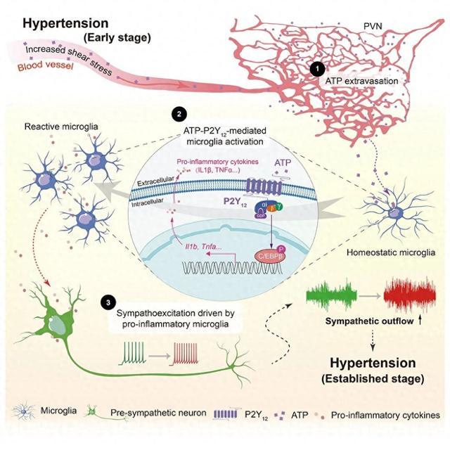 我国科学家发现高血压患者交感神经兴奋病因