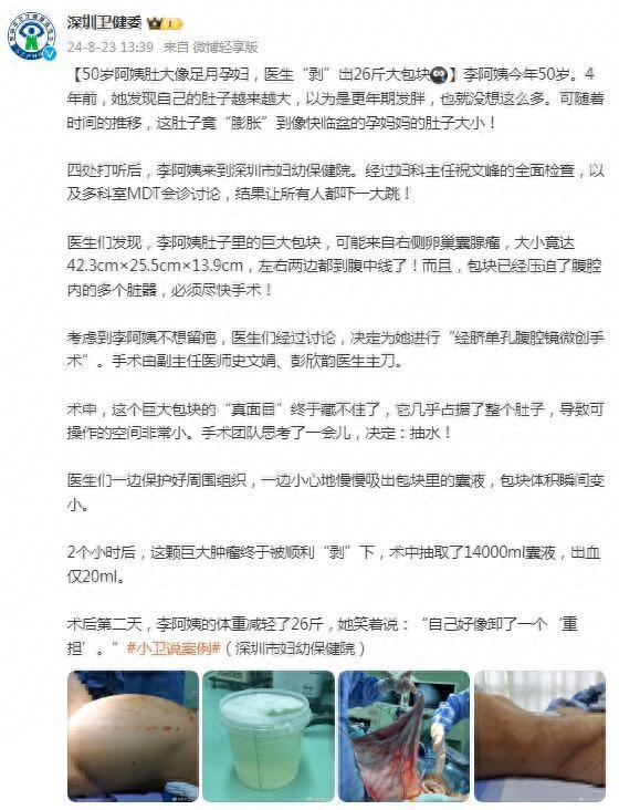 50岁阿姨肚大像足月孕妇，医生“剥”出26斤大包块