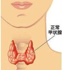 【疾病防治】如何区别甲状腺结节的良、恶性(图4)