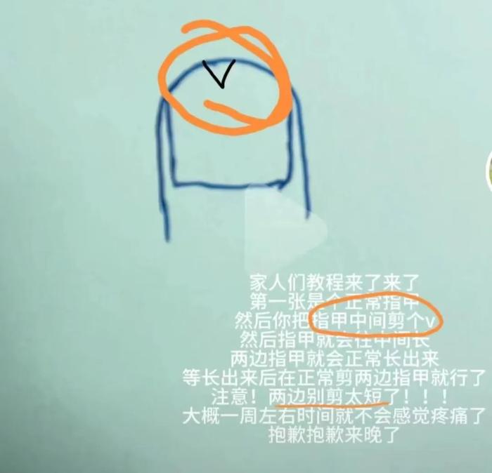 图片来源于网络