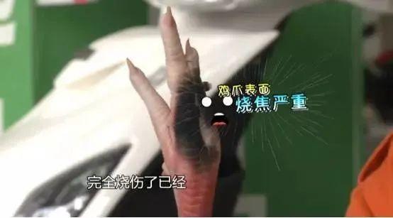 看着都疼！1岁宝宝手指瞬间烧黑，被紧急送医……不少人中招→