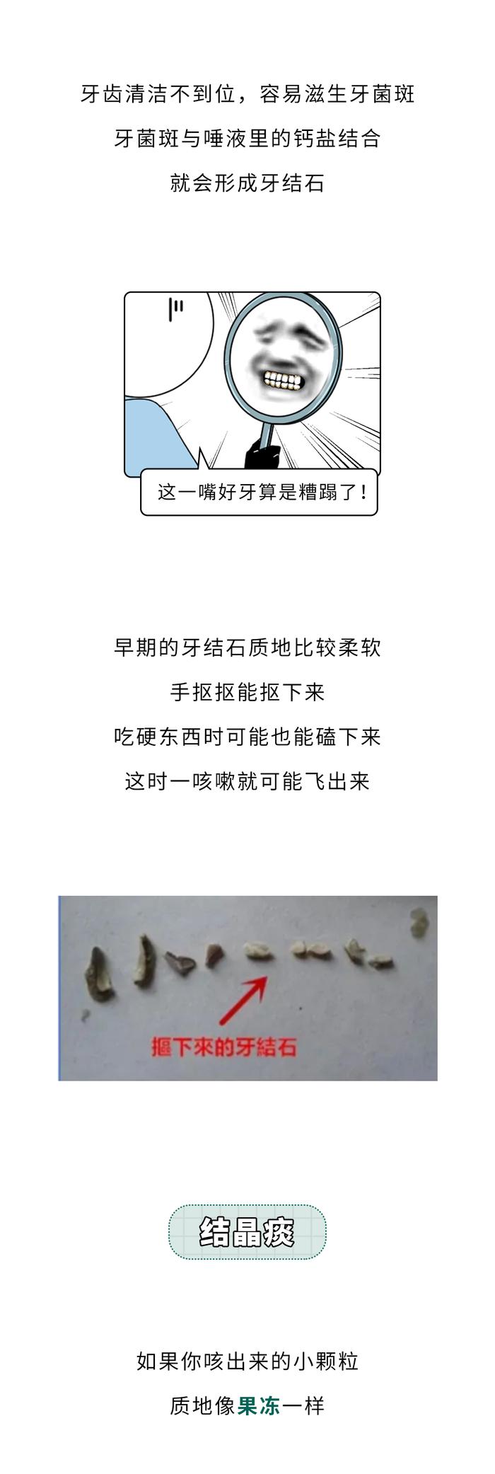 嘴里咳出来贼臭的黄色小颗粒，到底是啥？？？