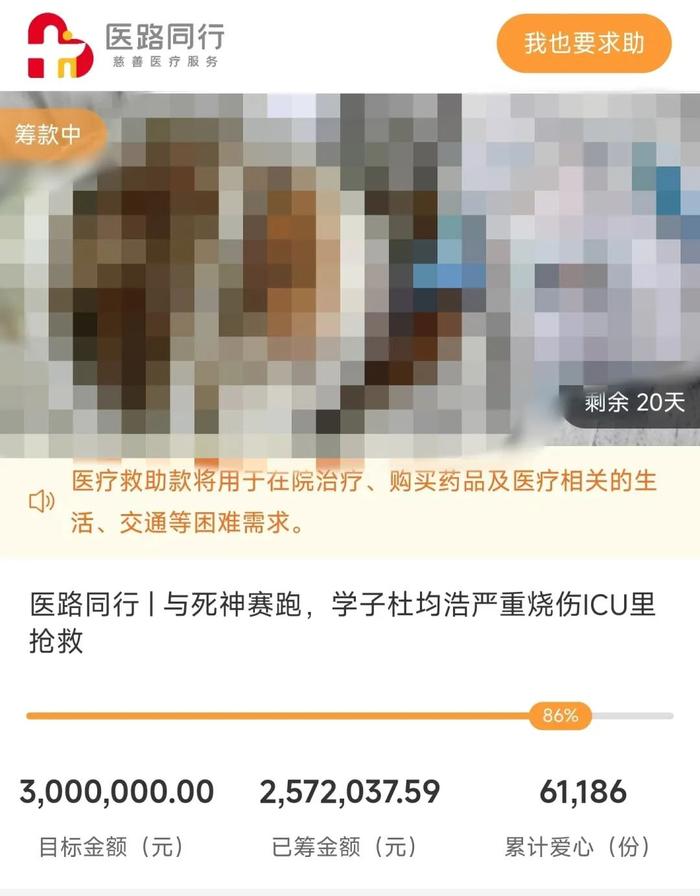 室友电动车电池起火致男生全身90%烧伤，“已植皮五次，均从父母的躯干和头部取皮”