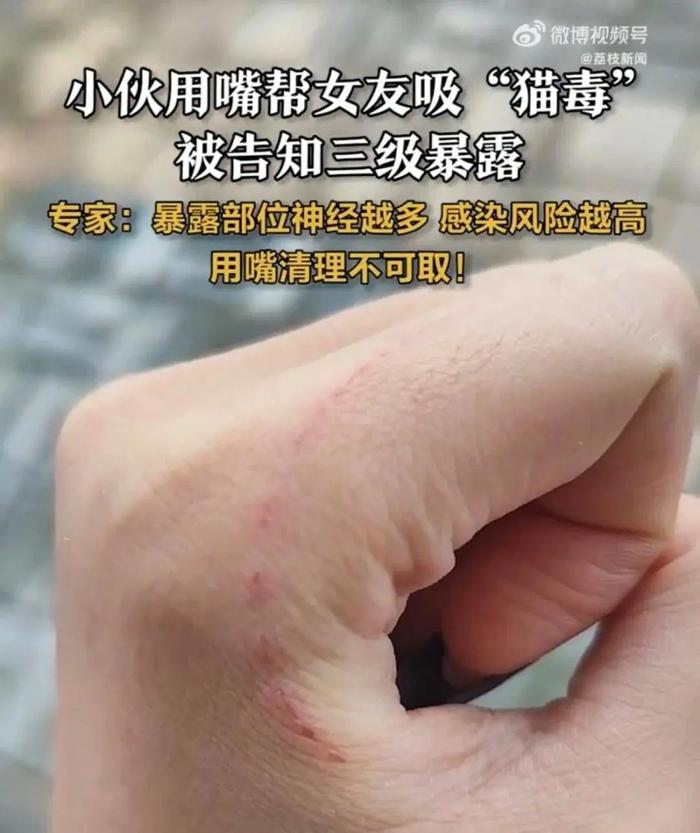 此病致死率近100%！危险就在你我身边→