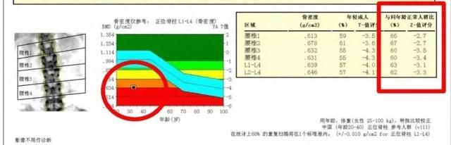 才27岁！新手妈妈被确诊，情况严重！医生：这个时期出现更危险……