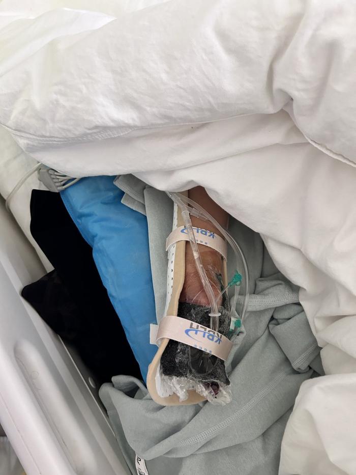 10岁男童玩未燃尽礼花右手被炸伤,医生:三个手指缺损