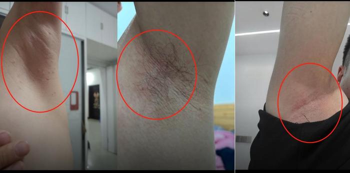 禾安堂腋下护理产品涉嫌虚假宣传:百万销量背后投诉不断(图2)