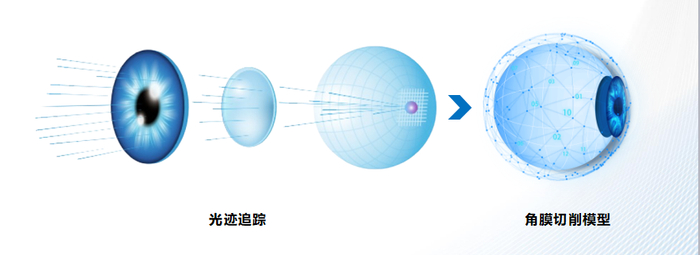 什么是对比敏感度尖峰眼科：视力≠视觉质量，这种近视手术术后夜视力质量更优？_https://www.jmylbn.com_新闻资讯_第12张