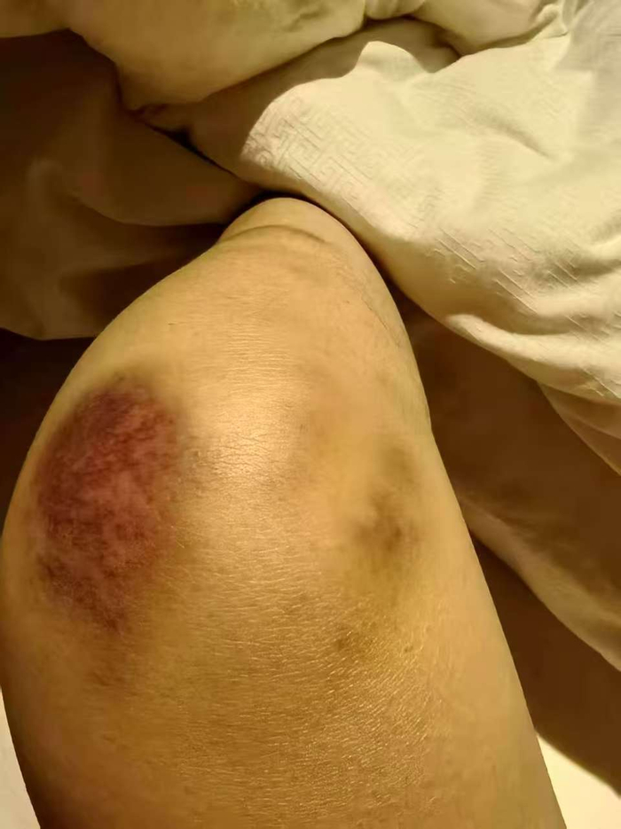 以“爱”为名的毒杀