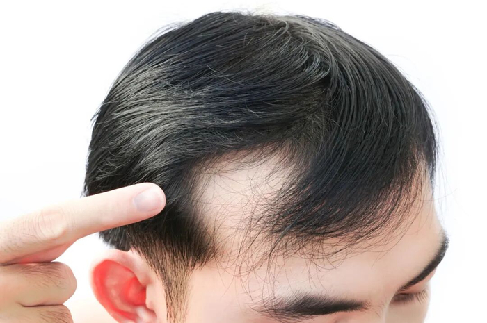 怎么快速增长头发 w700d1q75cms.jpg