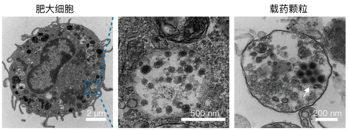中国科学家,发现抗癌“新利器”!