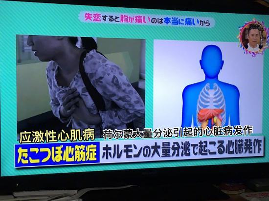 囧哥:男子玩游戏不约会 女友怒烧床单并拉他淋雨 然而…