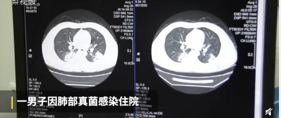 囧哥:时尚界玄学！平价货改洋名装高奢抬价20倍后…