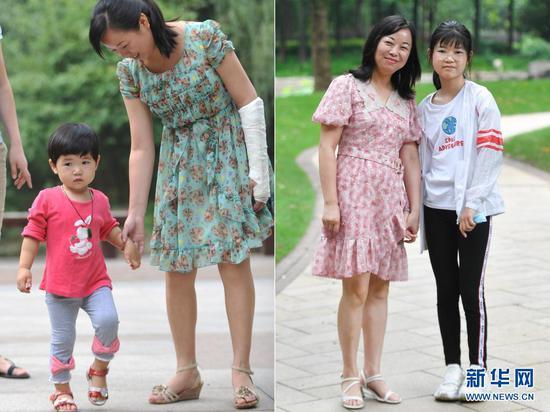 这是一张拼版照片,左图为:2011年9月12日,吴菊萍牵着妞妞在浙江杭州一小区散步;右图为:7月1日,吴菊萍与妞妞在浙江杭州一小区留影。新华社记者 黄宗治 摄