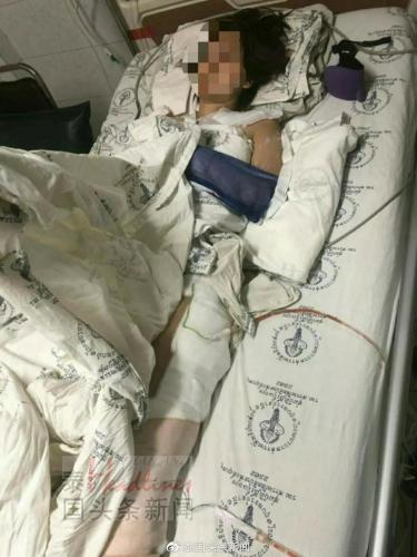 跌落悬崖的王姓女士被救援后,就一直在重症监护室。(图片来源:泰国头条新闻 王女士供图)