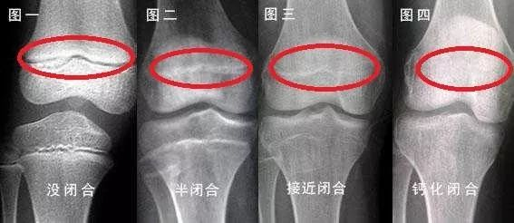 �����˳���ָ�ϣ��ܲ����ٳ���5cm���ؼ��������λ