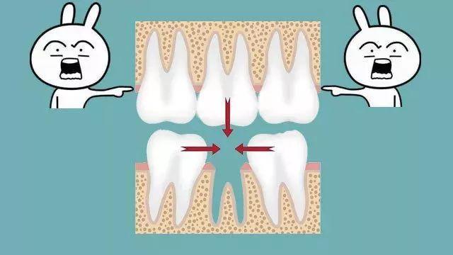 注意了！你牙齿上这个小黑洞，是个烧钱的无底洞