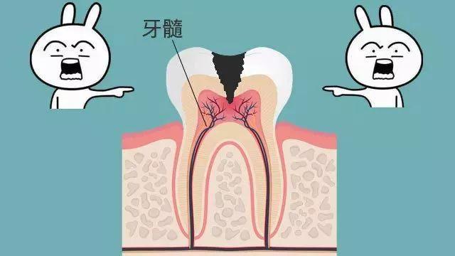 注意了！你牙齿上这个小黑洞，是个烧钱的无底洞