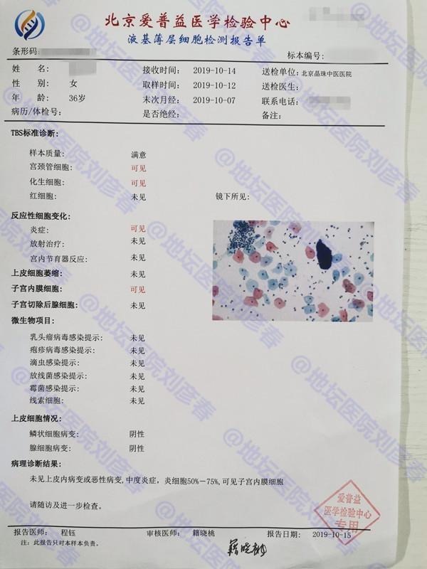 CIN3级累腺，不锥切还能怎么样？刀下留“宫颈”同样也能痊愈