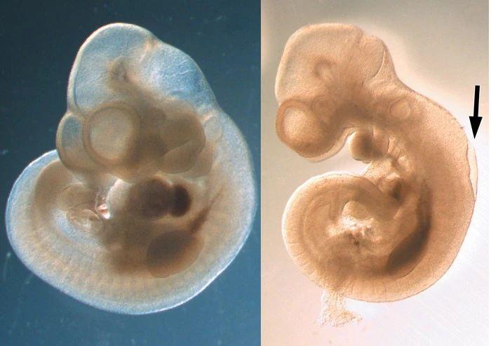 左图为正常小鼠胚胎,右图为神经管发育缺陷胚胎。图片来源:Birth Defects Res. | C&EN
