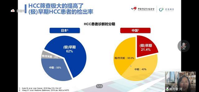 南月敏教授《HCC流行病学与诊治现状》