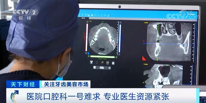 牙齿美容火了！急缺牙医！深圳3000多人才有1名牙医？口腔科一号难求→